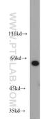 Lymphocyte Cytosolic Protein 1 antibody, 13025-1-AP, Proteintech Group, Western Blot image 