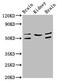 Angiopoietin 2 antibody, CSB-PA05749A0Rb, Cusabio, Western Blot image 