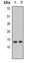 Norrin Cystine Knot Growth Factor NDP antibody, abx225311, Abbexa, Western Blot image 
