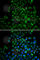 Fatty Acid Binding Protein 4 antibody, A0232, ABclonal Technology, Immunofluorescence image 