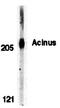 Apoptotic Chromatin Condensation Inducer 1 antibody, orb74392, Biorbyt, Western Blot image 