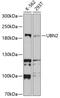 Ubinuclein 2 antibody, 13-703, ProSci, Western Blot image 
