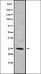 Ras-related protein Rab-39B antibody, orb338625, Biorbyt, Western Blot image 
