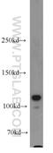 Hsp110 antibody, 13383-1-AP, Proteintech Group, Western Blot image 