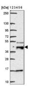 DEK Proto-Oncogene antibody, NBP2-38834, Novus Biologicals, Western Blot image 