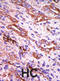 Rhodopsin kinase antibody, abx033108, Abbexa, Immunohistochemistry frozen image 