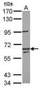Lin-54 DREAM MuvB Core Complex Component antibody, GTX120890, GeneTex, Western Blot image 