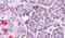 Leucine Rich Repeat Neuronal 4 antibody, PA5-33910, Invitrogen Antibodies, Immunohistochemistry paraffin image 
