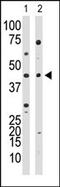YY1 Transcription Factor antibody, AP12240PU-N, Origene, Western Blot image 