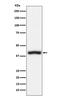 CD1c Molecule antibody, M01188-3, Boster Biological Technology, Western Blot image 