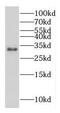 Microtubule-associated protein RP/EB family member 3 antibody, FNab02612, FineTest, Western Blot image 