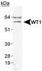 WT1 Transcription Factor antibody, TA301555, Origene, Western Blot image 