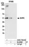 Sedoheptulokinase antibody, A305-719A-M, Bethyl Labs, Immunoprecipitation image 