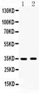 Hydroxysteroid 17-Beta Dehydrogenase 6 antibody, LS-C312551, Lifespan Biosciences, Western Blot image 