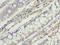 Catsper Channel Auxiliary Subunit Epsilon antibody, LS-C394650, Lifespan Biosciences, Immunohistochemistry paraffin image 