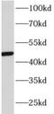Adaptor Related Protein Complex 3 Subunit Mu 1 antibody, FNab00466, FineTest, Western Blot image 