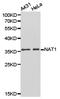 N-Acetyltransferase 1 antibody, LS-B14262, Lifespan Biosciences, Western Blot image 