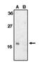 Survivin antibody, orb108733, Biorbyt, Western Blot image 