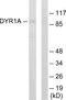 Dual Specificity Tyrosine Phosphorylation Regulated Kinase 1A antibody, A30487, Boster Biological Technology, Western Blot image 