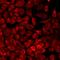 5'-Aminolevulinate Synthase 2 antibody, LS-C667671, Lifespan Biosciences, Immunofluorescence image 