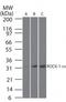 Rho Associated Coiled-Coil Containing Protein Kinase 1 antibody, TA336423, Origene, Western Blot image 