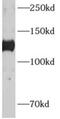 Adenylate Cyclase 6 antibody, FNab00157, FineTest, Western Blot image 