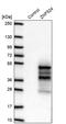 Zinc Finger Protein 524 antibody, PA5-62283, Invitrogen Antibodies, Western Blot image 