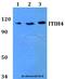 Inter-Alpha-Trypsin Inhibitor Heavy Chain 4 antibody, A03593, Boster Biological Technology, Western Blot image 