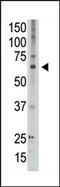 Melanoma-associated antigen D2 antibody, AP13142PU-N, Origene, Western Blot image 