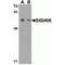 Single Ig And TIR Domain Containing antibody, TA306181, Origene, Western Blot image 