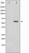 ER-beta antibody, TA327896, Origene, Western Blot image 