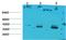 Calcium Binding Protein 2 antibody, A12207, Boster Biological Technology, Western Blot image 