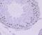 DNA ligase antibody, NBP2-75473, Novus Biologicals, Immunohistochemistry paraffin image 