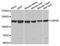 Ubiquitin carboxyl-terminal hydrolase 26 antibody, A7999, ABclonal Technology, Western Blot image 