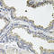 Aconitase 1 antibody, LS-C409416, Lifespan Biosciences, Immunohistochemistry frozen image 