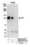 PHD finger protein 12 antibody, NB100-81670, Novus Biologicals, Western Blot image 