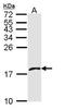 platelet factor 4 variant 1 antibody, orb74171, Biorbyt, Western Blot image 