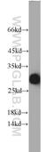 Amyloid P Component, Serum antibody, 20773-1-AP, Proteintech Group, Western Blot image 