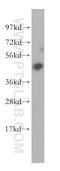 BAF Chromatin Remodeling Complex Subunit BCL7B antibody, 11740-1-AP, Proteintech Group, Western Blot image 