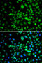 SET Domain Containing 5 antibody, MBS9126044, MyBioSource, Immunofluorescence image 