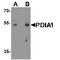 Prolyl 4-Hydroxylase Subunit Beta antibody, TA349184, Origene, Western Blot image 