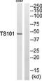 Death-inducer obliterator 1 antibody, TA315149, Origene, Western Blot image 