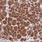 Zinc Finger Protein 565 antibody, NBP1-81951, Novus Biologicals, Immunohistochemistry paraffin image 