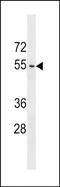 Actin Like 9 antibody, PA5-48851, Invitrogen Antibodies, Western Blot image 