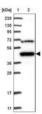 Makorin Ring Finger Protein 2 antibody, NBP1-83178, Novus Biologicals, Western Blot image 