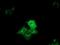 Cytoplasmic dynein 1 light intermediate chain 1 antibody, MA5-25195, Invitrogen Antibodies, Immunocytochemistry image 