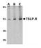Cytokine receptor-like factor 2 antibody, AP07146PU-N, Origene, Western Blot image 