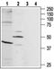 BKRB1 antibody, PA5-77292, Invitrogen Antibodies, Western Blot image 