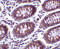 MHC Class I Polypeptide-Related Sequence A antibody, 4261, ProSci, Immunohistochemistry paraffin image 