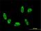 Alpha-protein kinase 3 antibody, H00057538-M01, Novus Biologicals, Immunocytochemistry image 